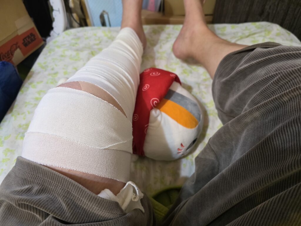 膝を怪我して添え木を包帯で固定している様子