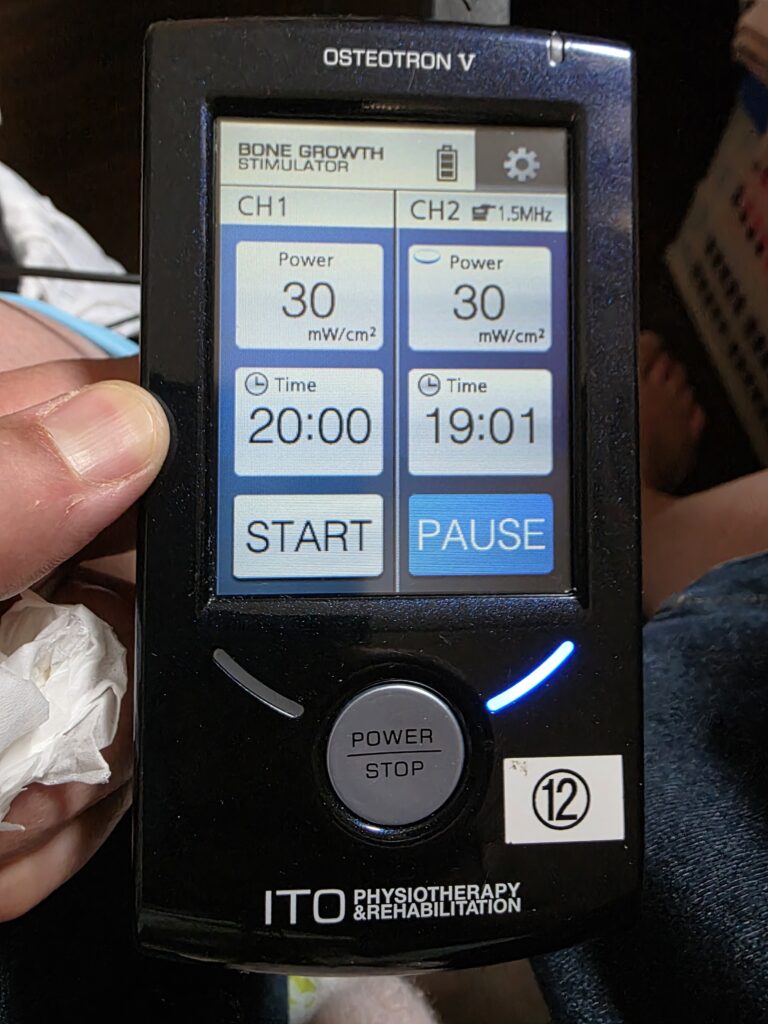 LIPUS治療機オステオトロンVの操作画面（20分照射設定）